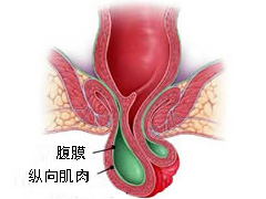济南肛肠医院，脱肛