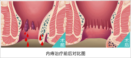 济南肛肠医院